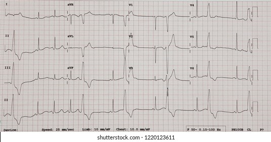 Rvot Pvc Bilder Stockfoton Och Vektorer Med Shutterstock