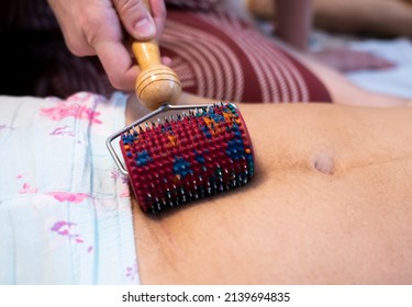 Postpartum Doula Shows How To Massage A Cesarean Scar With A Lyapko Applicator. Recovery Procedures After Childbirth.