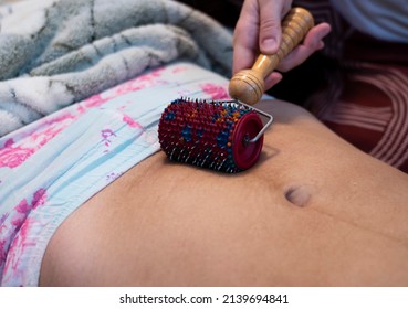 Postpartum Doula Shows How To Massage A Cesarean Scar With A Lyapko Applicator. Recovery Procedures After Childbirth.