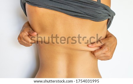 Posture showing back muscles that are slack, not firm, women