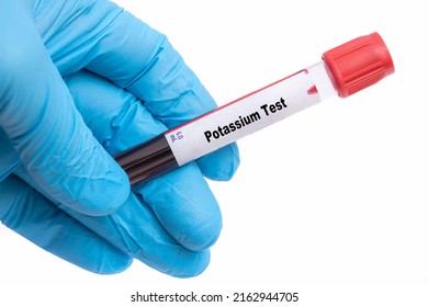 Potassium Test Medical Check Up Test Tube With Biological Sample