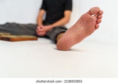 Practice of standing on nails. Sadhu wooden board with nails for sadhu practice. Young guy resting after practice sitting on the floor. Close-up of sole with nail marks