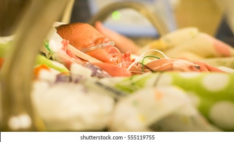 Preemie Baby Girl Asleep In The Nicu