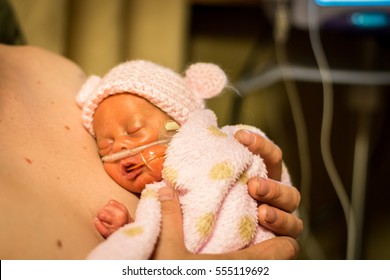 Preemie Baby Girl Gets Some Skin To Skin With Her Dad In The Nicu