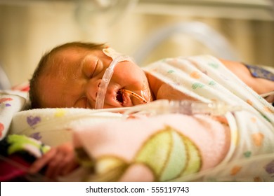 Preemie Baby Girl Sleeping In The Nicu