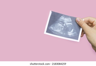 Pregnancy And Baby Waiting Concept. Ultrasound Picture With Fetus In Uterus In Woman's Hand,on Pink Background.gestation Periods.sonogram Of Fetus, Unborn Yet Baby, Flat Lay, Love Care.woman Knees.