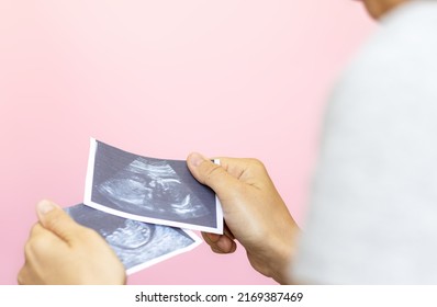 Pregnancy And Baby Waiting. Ultrasound Picture With Fetus In Uterus In Woman's Hand,on Pink Background.2 Different Gestation Periods.sonogram Of Fetus, Unborn Yet Baby, Flat Lay, Love Care