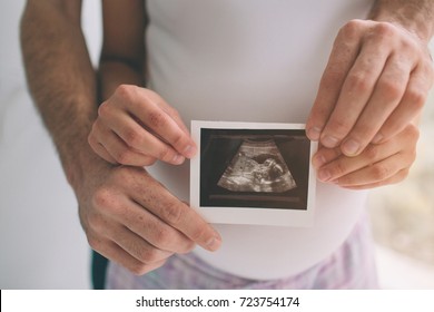 Pregnant Couple Holding Ultrasound Scan. Concept Of Pregnancy Health Care.