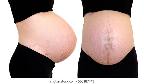 Pregnant woman 40 weeks, Pregnant, Close up of a cute pregnant belly, Isolate and Clipping Path - Shutterstock ID 568187443