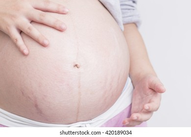 Pregnant woman applying skin care cream on belly