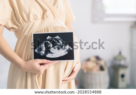Pregnant woman and echo photograph. Maternity photography.