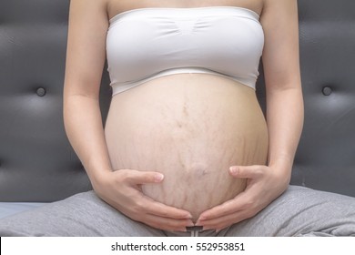 Pregnant woman hands hold belly, concept of pregnant stretch marks or scar.