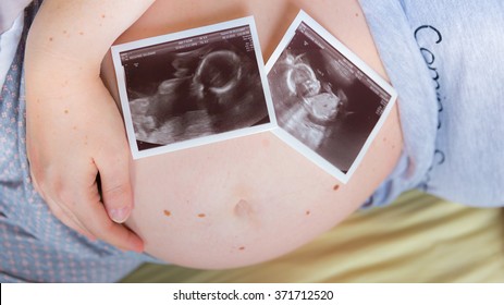 Pregnant Woman Holding Her Belly With Two Ultrasound Scans Of Twins On Her Tummy