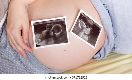 Pregnant Woman Holding Her Tummy With Two Ultrasound Scans Of Twins On Her Belly