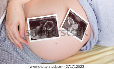 Pregnant woman holding her tummy with two ultrasound scans of twins on her belly