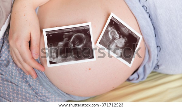 Pregnant woman holding her tummy with two\
ultrasound scans of twins on her\
belly