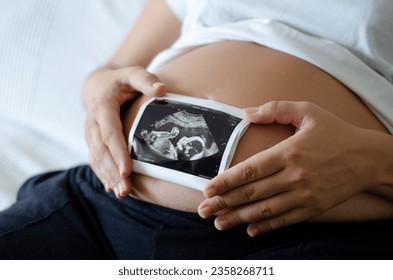 Pregnant woman holding an ultrasound image of the baby. Close-up of pregnant belly and ultrasound photography in mother's hands. Untied and healthy pregnancy concept