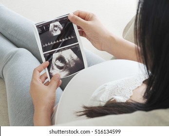 Pregnant Woman Holding Ultrasound Scan. Concept Of Pregnancy Health Care.