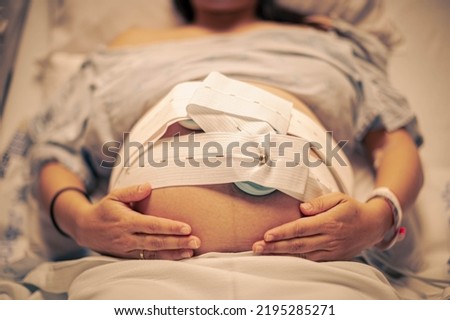 A pregnant woman in the hospital having contractions. Pregnancy cardiogram, fetal heartbeat.