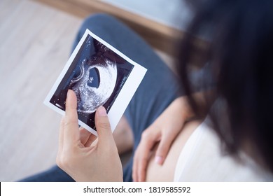 Una mujer embarazada está mirando una foto en ultrasonido del feto. La madre toca suavemente al bebé con el estómago. Las mujeres están embarazadas durante 2-3 días o durante el primer trimestre.