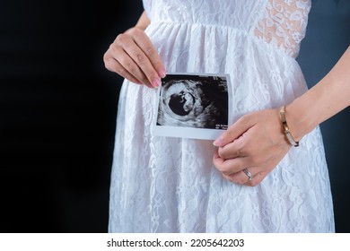 A Pregnant Woman In A Maternity Dress With An Ultrasound Photo (shooting A Real Full-term Pregnant Woman)