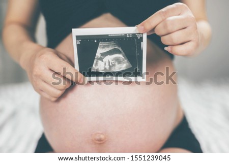 pregnant woman mom hand holding film ultrasound. the unborn baby in the belly. wait birth date expecting a Newborn stand in the outdoor.