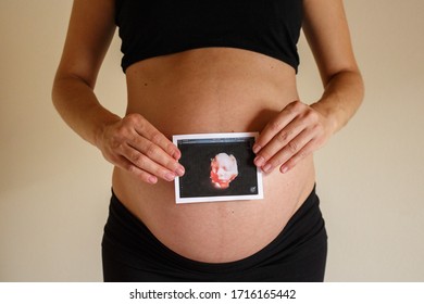 Pregnant Woman With A Photo 3D Ultrasound