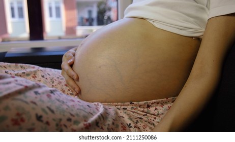Pregnant woman with pregnancy complications. Threats, varicose