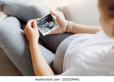 Pregnant woman with ultrasound image on sofa, top view. Concept expectant mother waiting for baby birth during pregnancy, light background.