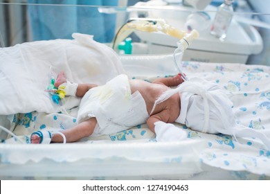 Premature Baby With A Catheter And A Neonatal Infant Oximeter On Legs Lying Inside The Incubator With Oxygen Mask