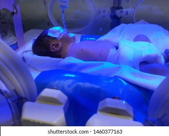 Premature Baby Lying In Incubator And Having A Treatment For Neonatal Hyperbilirubinemia Under Ultraviolet Light Therapy. Neonatal Intensive Care Unit (NICU), For Premature Newborn Infants.