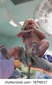 Premature Baby Twin Delivered Via Caesarian Section