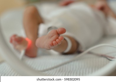 Premature Baby's Feet In The Neonatal Intensive Care Unit 
