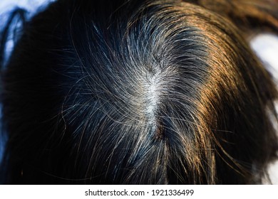 Premature Gray Hair Asian People Are Caused By Stress,Ideas For Maintaining Healthy Hair