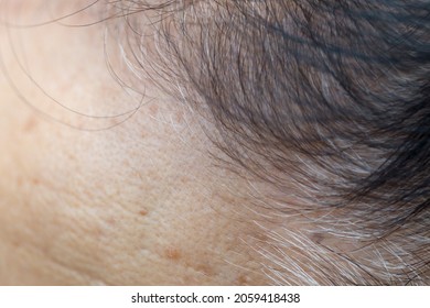 Premature Gray Hair In Humans Is Caused By Stress, Ideas For Maintaining Healthy Hair