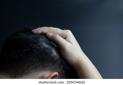 Premature Gray Hair. Young Asian Man Showing Gray Hair On His Head 