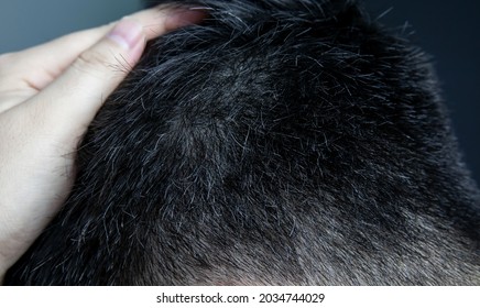 Premature Gray Hair. Young Asian Man Showing Gray Hair On His Head 