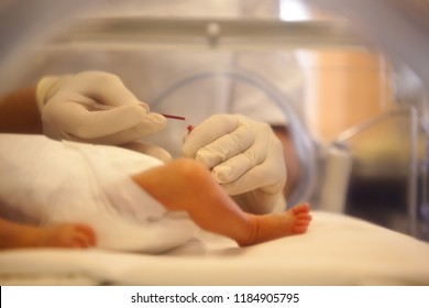 Premature Neonate In A Special Incubator