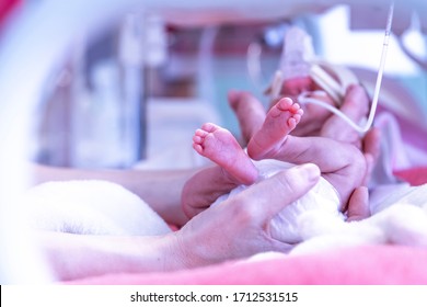 Premature newborn baby in incubator , ICu
