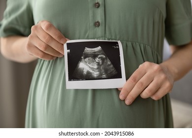 Prenatal ultrasound screening. Cropped close up shot of young pregnant female holding sonogram picture of unborn baby inside her big belly. Happy expectant mom showing fetus usi scan image to camera