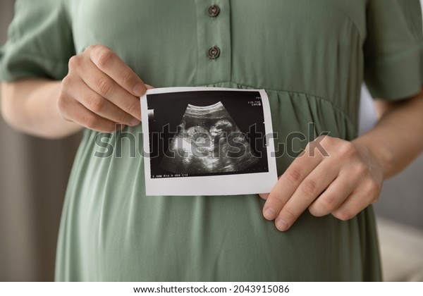 Prenatal ultrasound screening. Cropped close up\
shot of young pregnant female holding sonogram picture of unborn\
baby inside her big belly. Happy expectant mom showing fetus usi\
scan image to camera