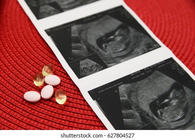 Prenatal Vitamins