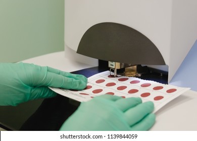 Preparation For Analysis In Samples Of Dry Blood. Screening Of Newborns For Hereditary Metabolic Diseases.