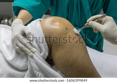 Preparation before intra articular injection.