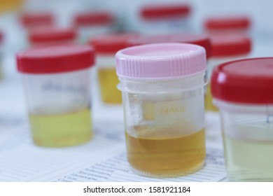 Urine Samples Analysis Stock Photo (Edit Now) 1232810302