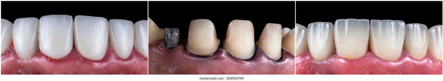 715 Dental B Images, Stock Photos & Vectors | Shutterstock