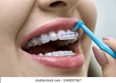 Pretty girl is showing her teeth with braces in a dental clinic. Dentist is cleaning her bracket system with a help of a special brush. Macro horizontal photo.