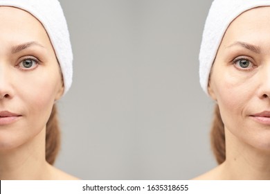 Pretty Mature Girl. Before And After Portrait. Anti Wrincle Healthy Therapy. Black Circle Under Eyes. Collagen Cream. Cosmetology Rejuvenation. Beauty Model. Procedure Result.