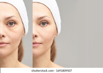 Pretty Mature Girl. Before And After Portrait. Anti Wrincle Healthy Therapy. Black Circle Under Eyes. Collagen Cream. Cosmetology Rejuvenation. Beauty Model. Procedure Result.