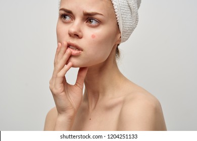 Download Pimples Face Mask Images Stock Photos Vectors Shutterstock PSD Mockup Templates